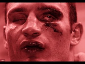 TOP 10 BUSTED CHIN BOXING MOMENTS